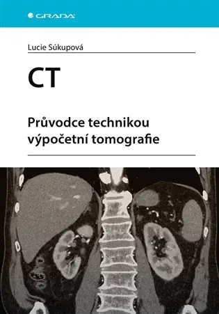 CT - Průvodce technikou výpočetní tomografie Sleva