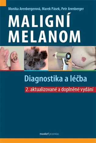 Tovární Cena Maligní melanom – Diagnostika a léčba