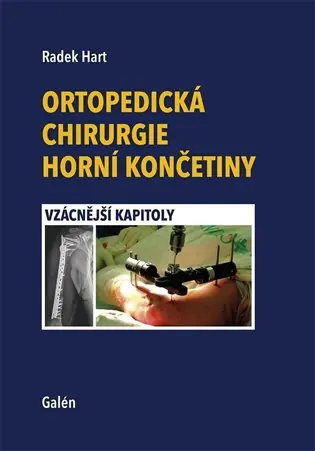 Nakupujte Hned Ortopedická chirurgie horní končetiny: Vzácnější kapitoly