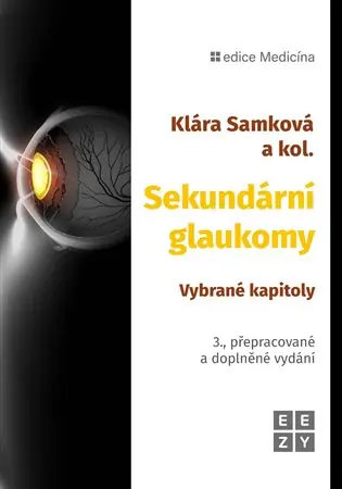 Sekundární glaukomy Aktuální