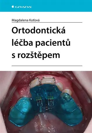 Aktuální Ortodontická léčba pacientů s rozštěpem